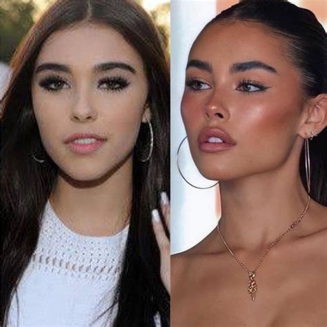 madison beer plastic surgery|Madison Beer Responds To Cosmetic Surgery Allegations